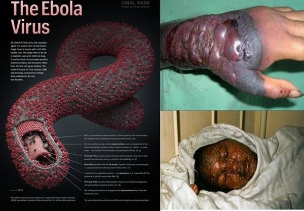 Ảnh 3 của Ebola